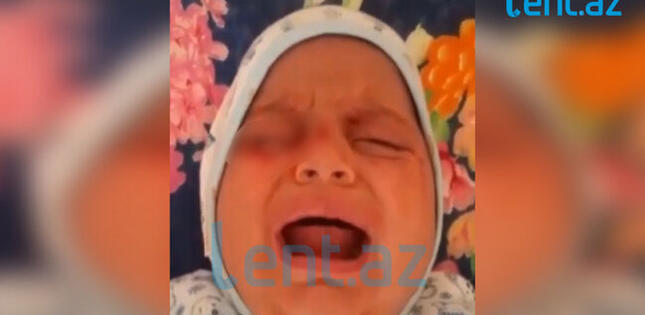 Azərbaycanda ŞOK: Körpənin gözlərinə COVID diaqnozu qoyuldu, qan gəlir