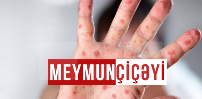 Meymunçiçəyinə görə riskli ölkələrdən Azərbaycana gələn sərnişinlərə xüsusi diqqət yetirilir